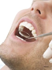 Close Up of Man's Mouth with a Dentist using a Mirror Tool to Examine Him